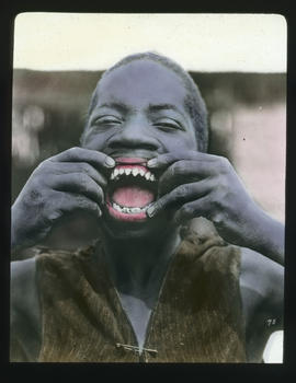 Black man displaying pointed teeth.