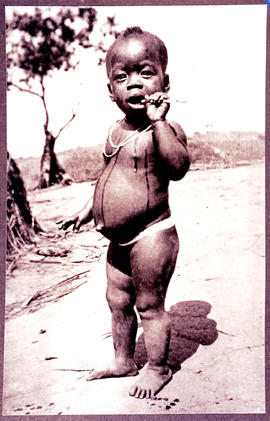 "Natal, 1932. Zulu toddler."